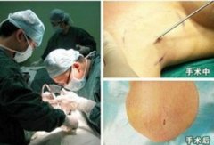 ���ݷ���Ƥ����ҽԺ